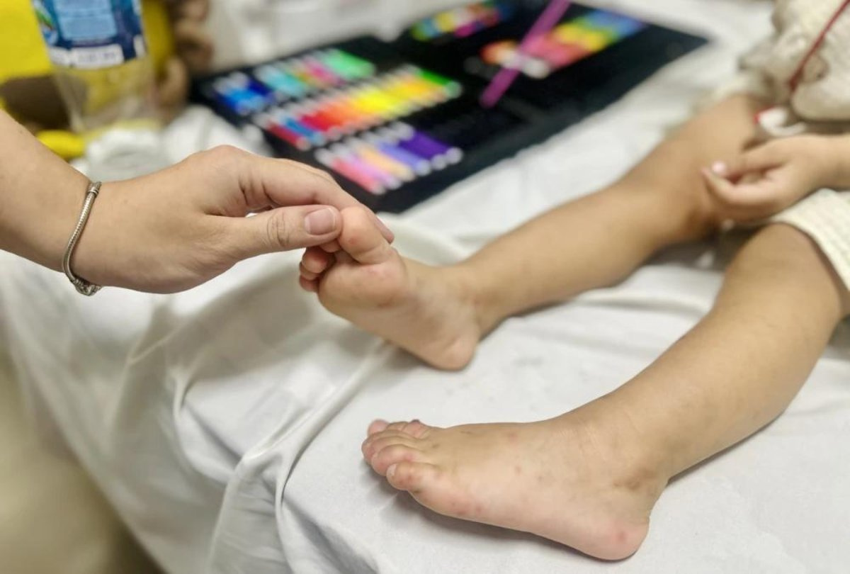 Bệnh Tay Chân Miệng Ở Trẻ: Dấu Hiệu Nhận Biết Và Cách Phòng Ngừa. Tìm hiểu dấu hiệu bệnh tay chân miệng ở trẻ, cách chăm sóc an toàn, nhận biết biến chứng nguy hiểm và biện pháp phòng ngừa hiệu quả cho gia đình.
